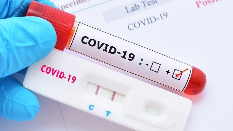 Bebê de apenas 1 ano morre após testar positivo para covid-19, em Balsas